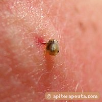 foto de aguijon con veneno de abeja HD